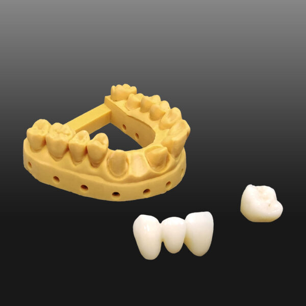JAMGHE Advanced Dental Crown Resin for Temporary Restorations – High Precision, A2/A3 Color, 250g - Image 2